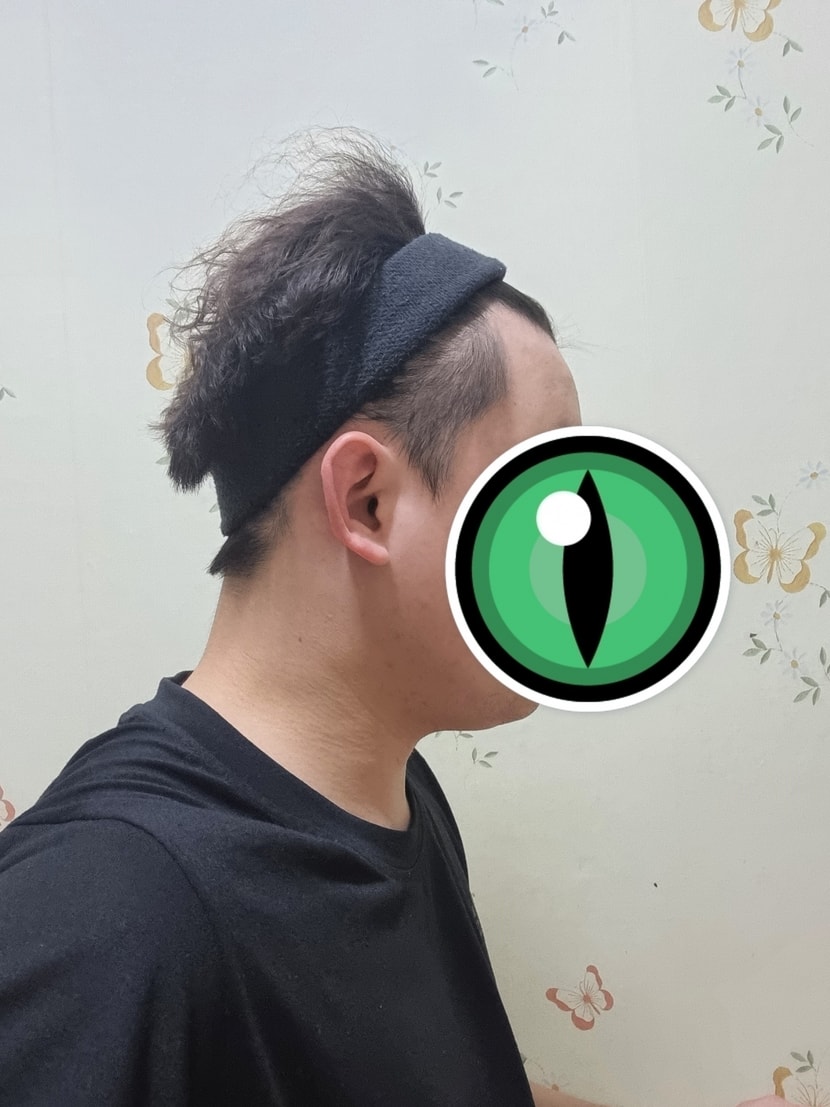 수술전