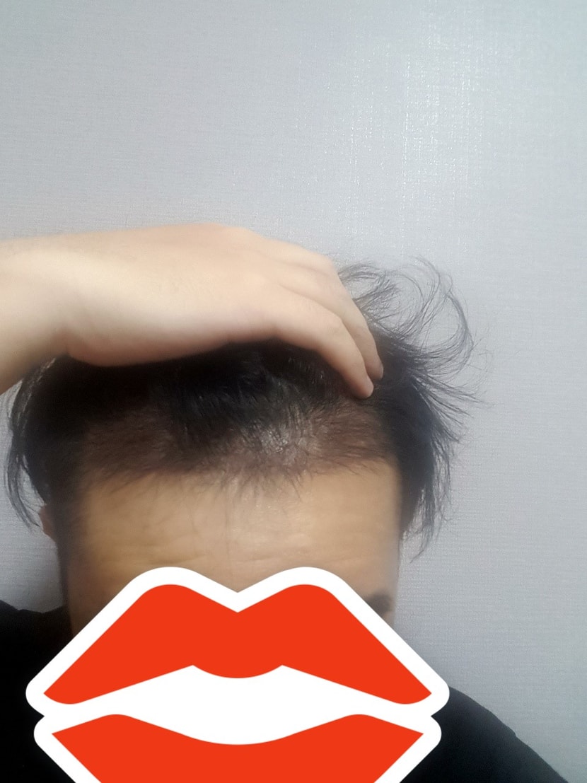 14일차