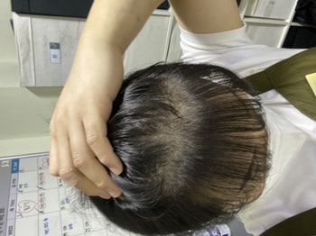 지금