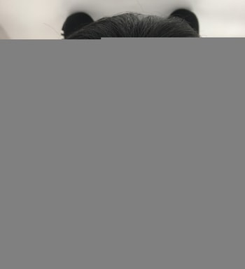 후