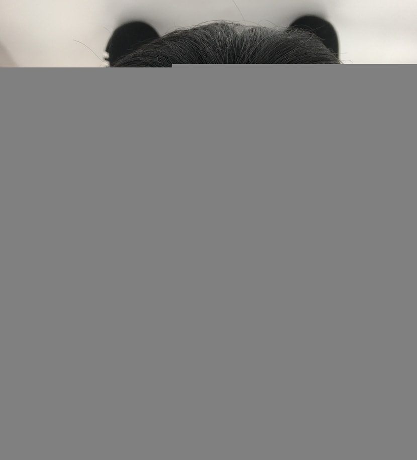 후