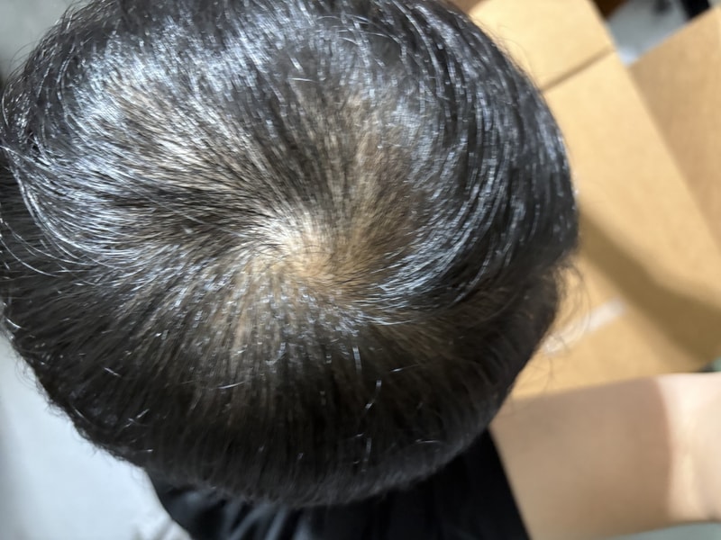 薄毛の方にご挨拶します