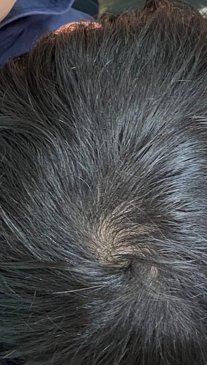 정수리 상태 어떤가요