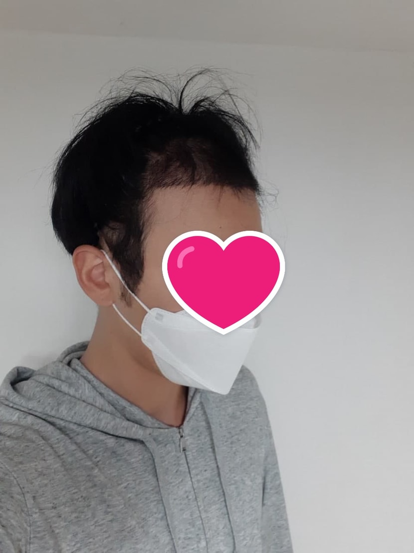 수술후