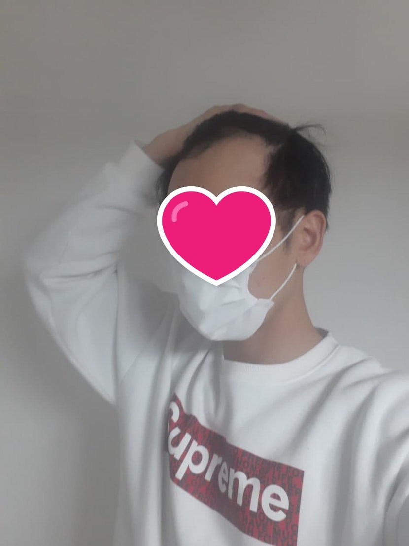수술전