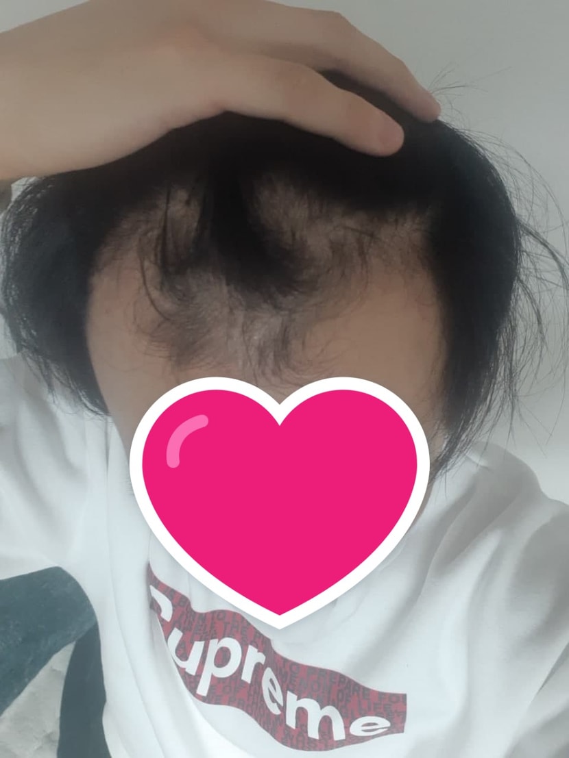 수술전