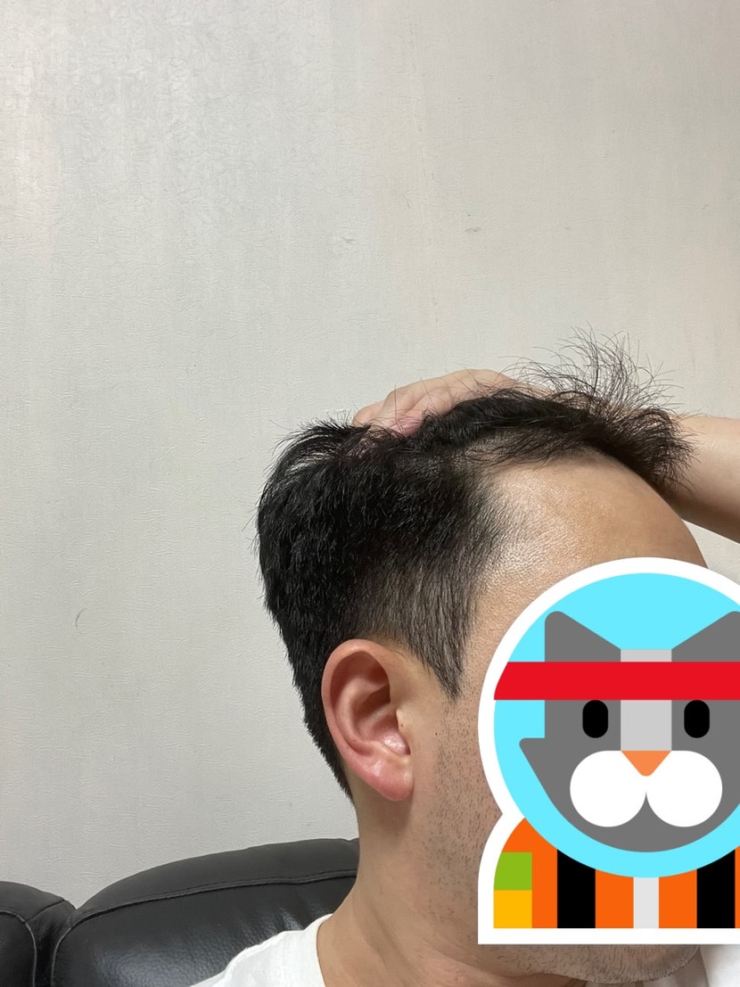 수술전