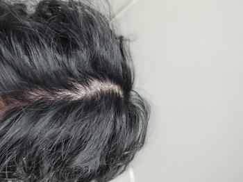 머리 떡진 상태에서 화장실 조명 직빵 받은 상태 