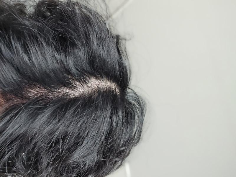 각도/조명/머리 떡짐에 따라 비어보이는 차이가 큽니다.