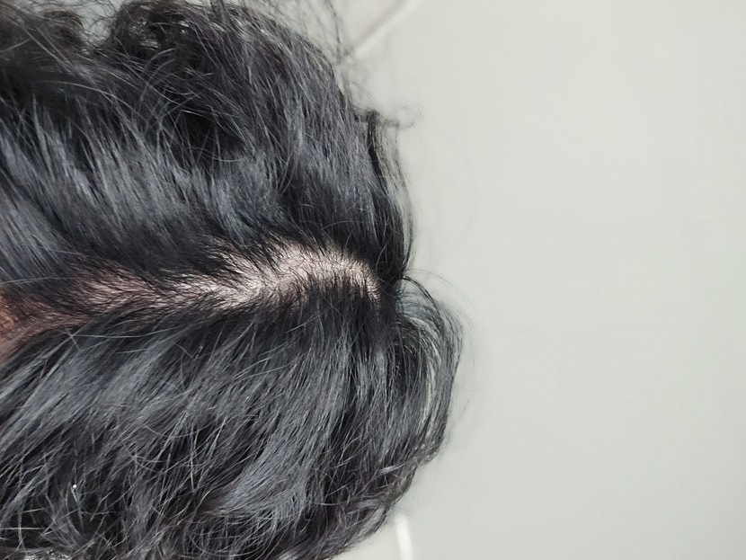머리 떡진 상태에서 화장실 조명 직빵 받은 상태 