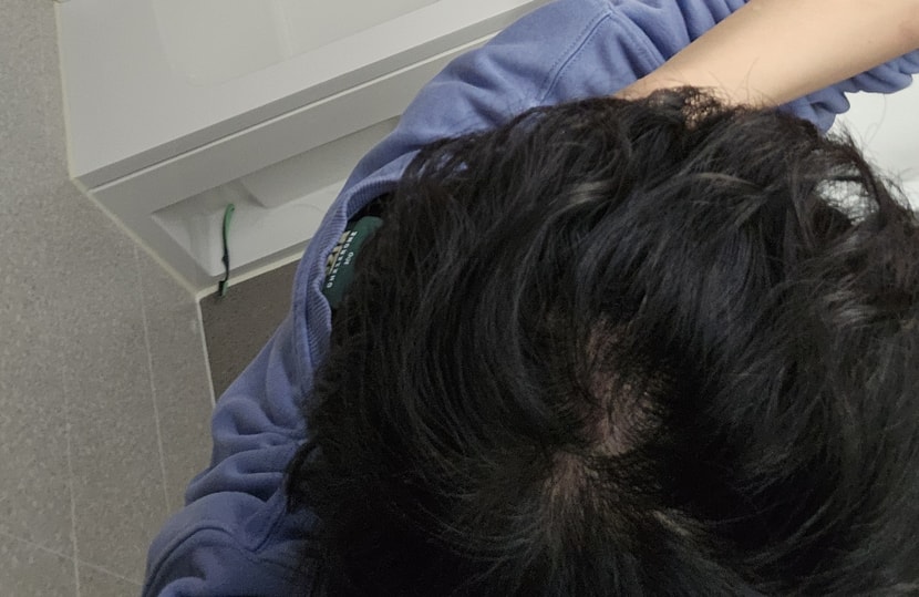머리 떡지지 않은 상태에서 화장실 조명 아래