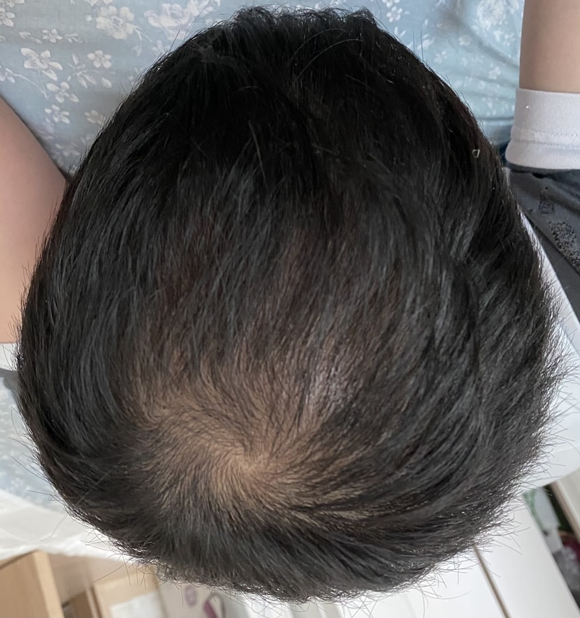현재