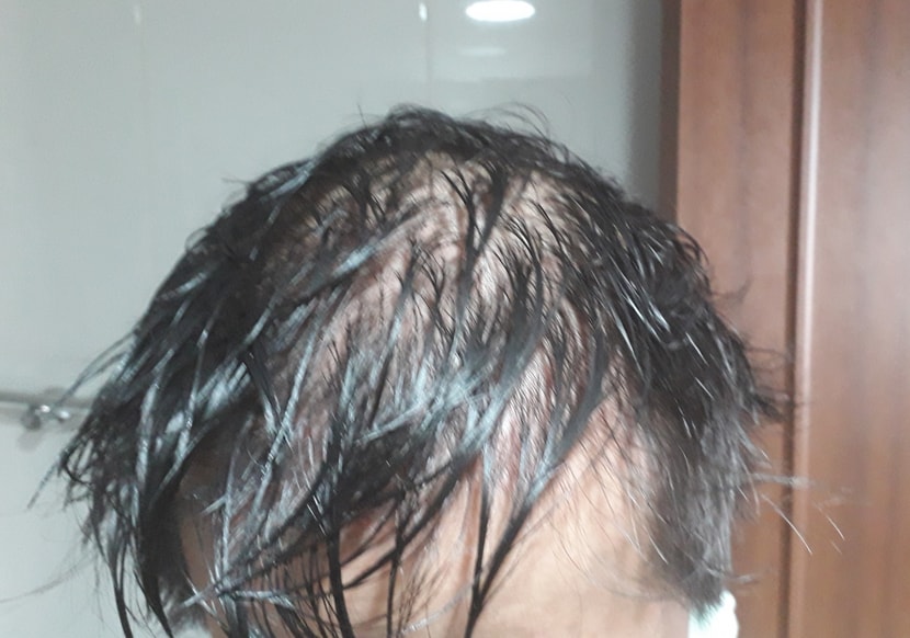 위에 있는 사진으로만 보면 숱이 얼마나 없는지 알 수 없는데 이정도로 없습니다.