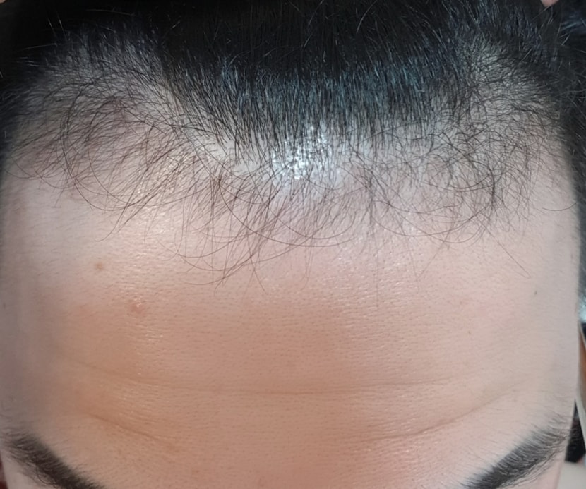 최근