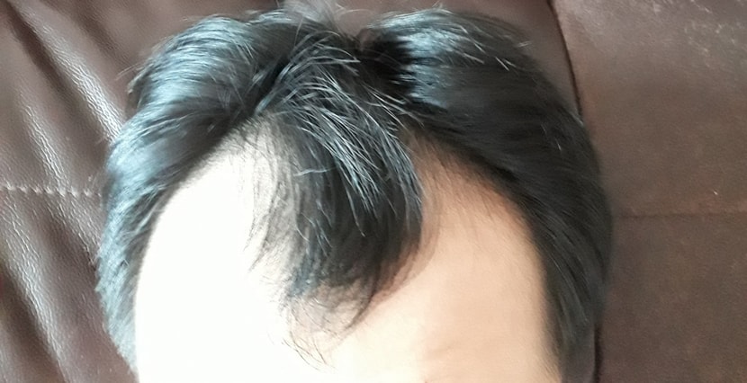 정면