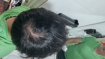 사용 1년 후