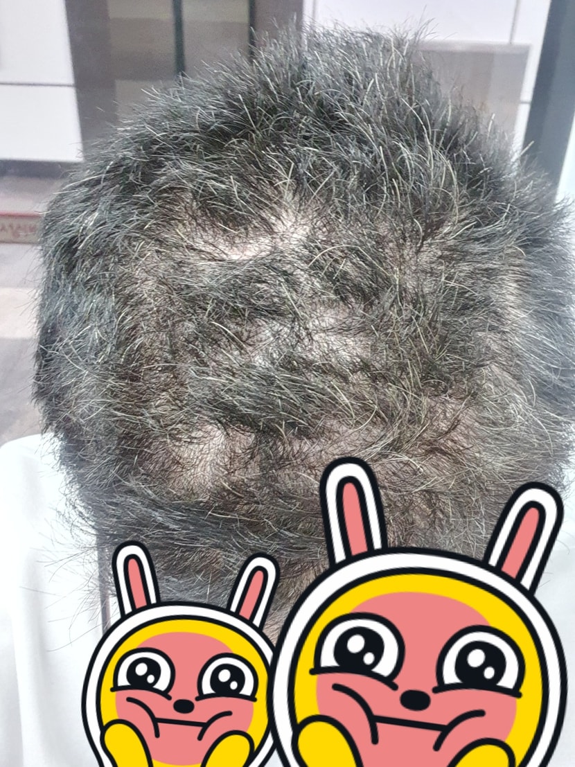 전