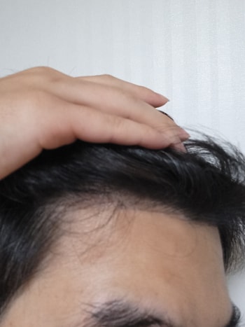 수술후