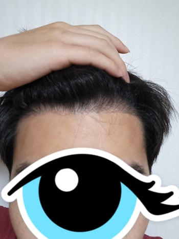 수술후