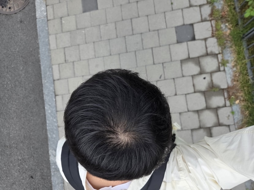 윗모습