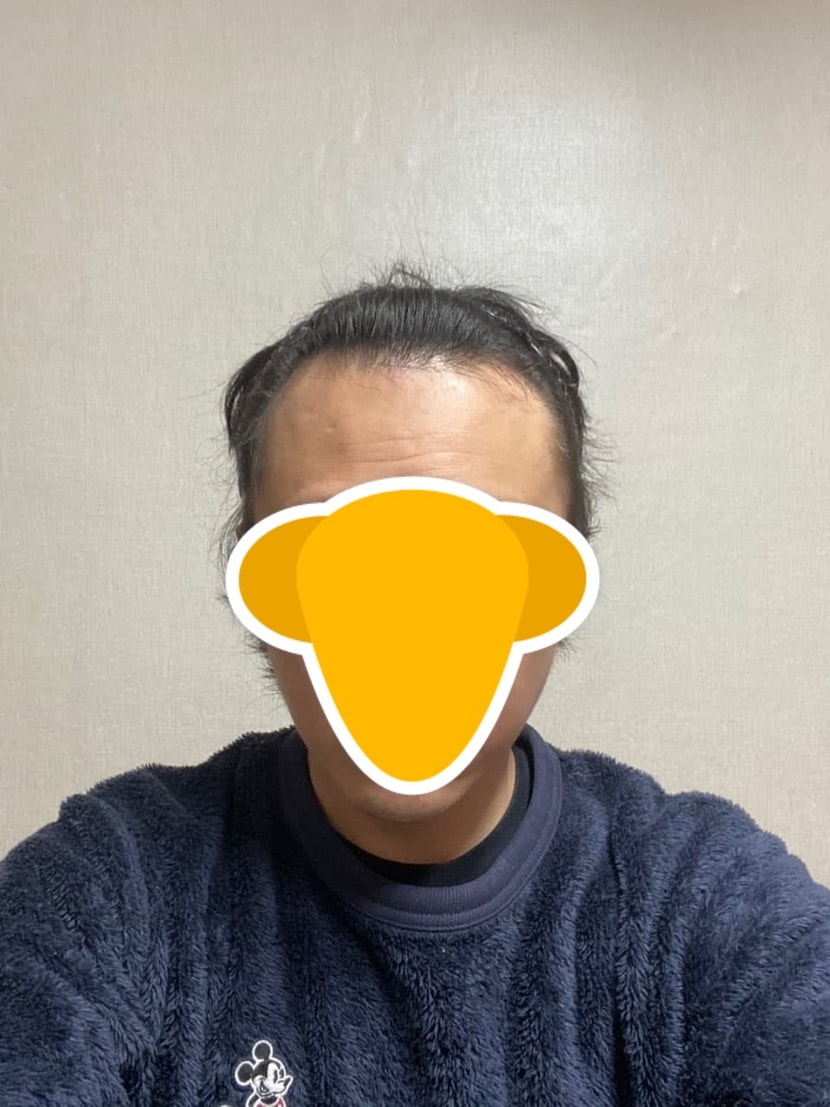 수술전