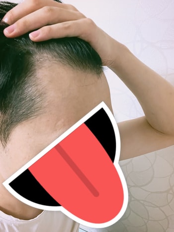 수술전