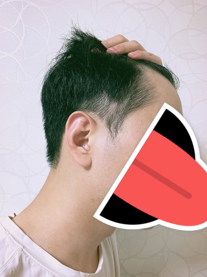 수술전