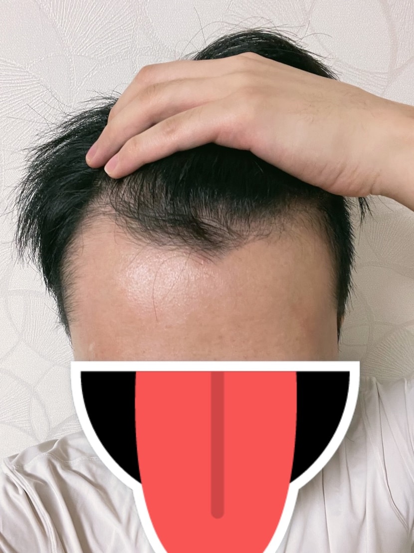 수술전