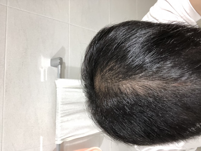 가르마 라인 (현재)