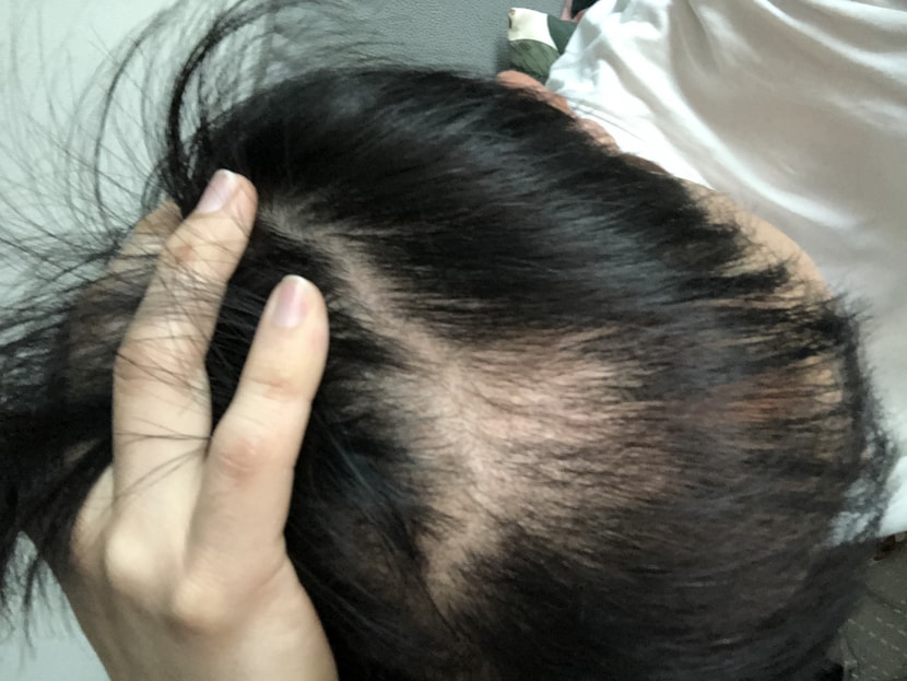 m자 위 부분 (2달 전)