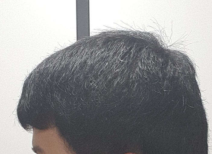 옆머리 1