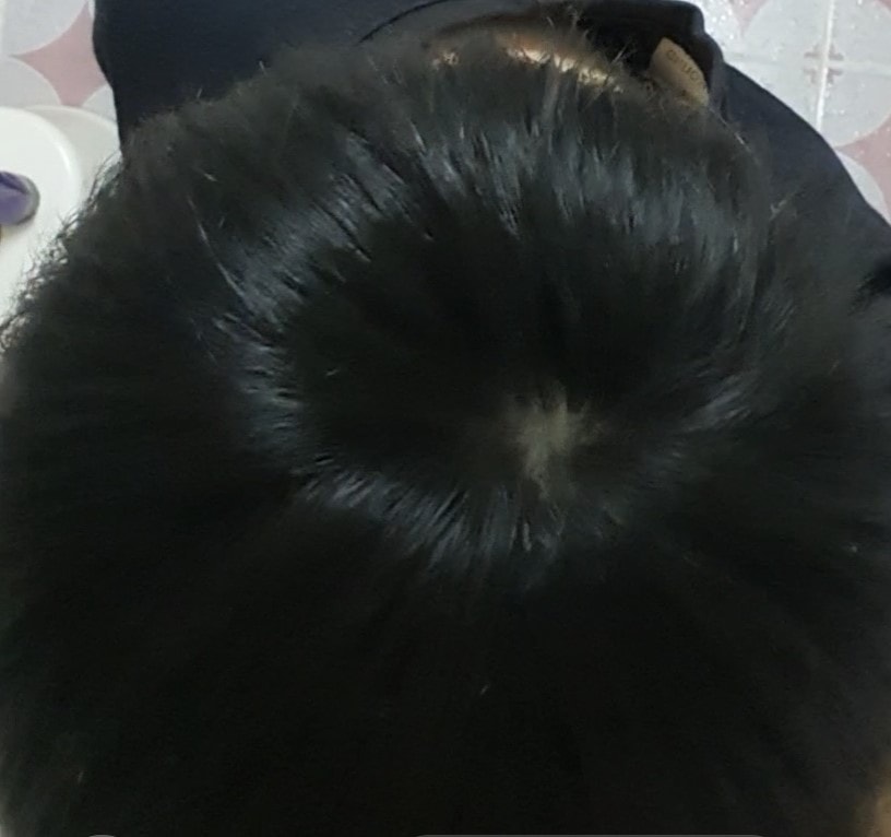 현재 사진2