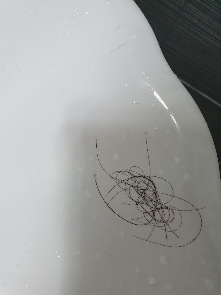 제 생각엔 탈모약 안드로겐 수용체 활성화 시키는것 같기도 하네요..