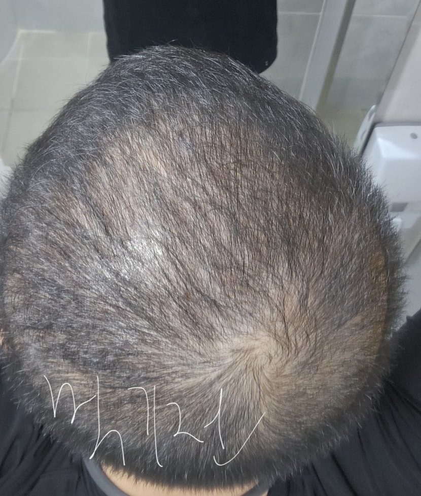 먹기전