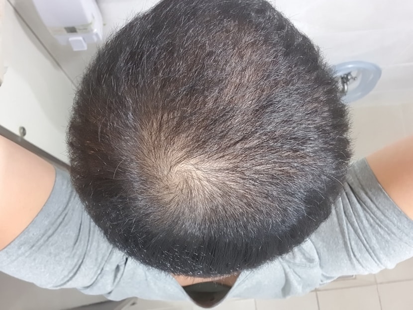 6년전
