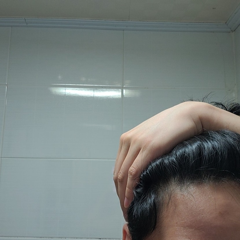 현재m자 측면. 처음과 비교했을때 올라간부분이 다시 내려옴. 첫 측면 사진은 기겁해서 당시에 삭제하는바람에 자료가 없다 ㅜ