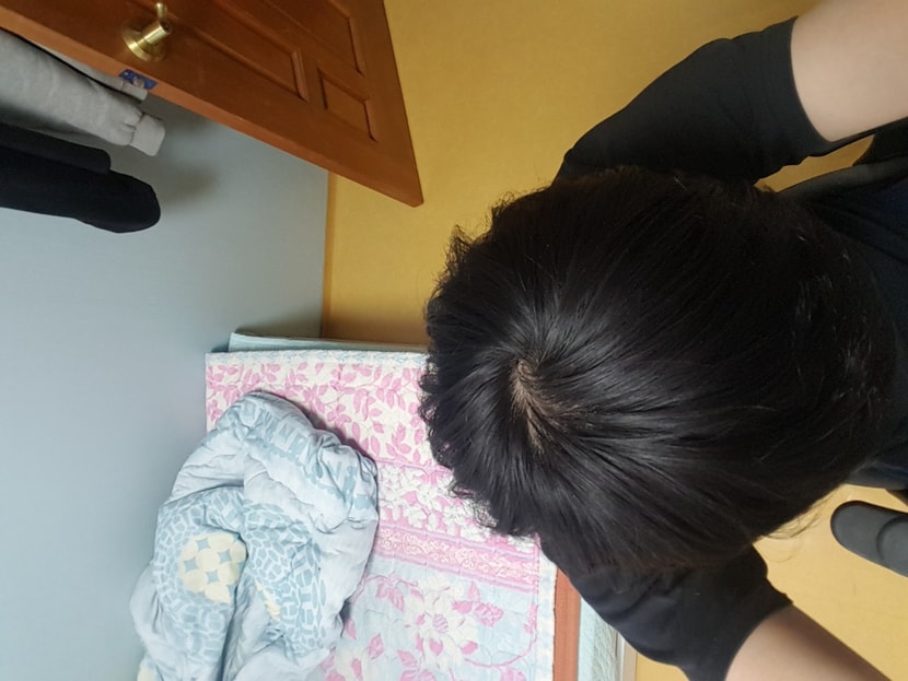 &lt;현재 정수리 사진입니다&gt;