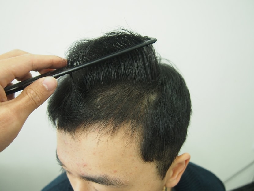 수술후 촬영사진