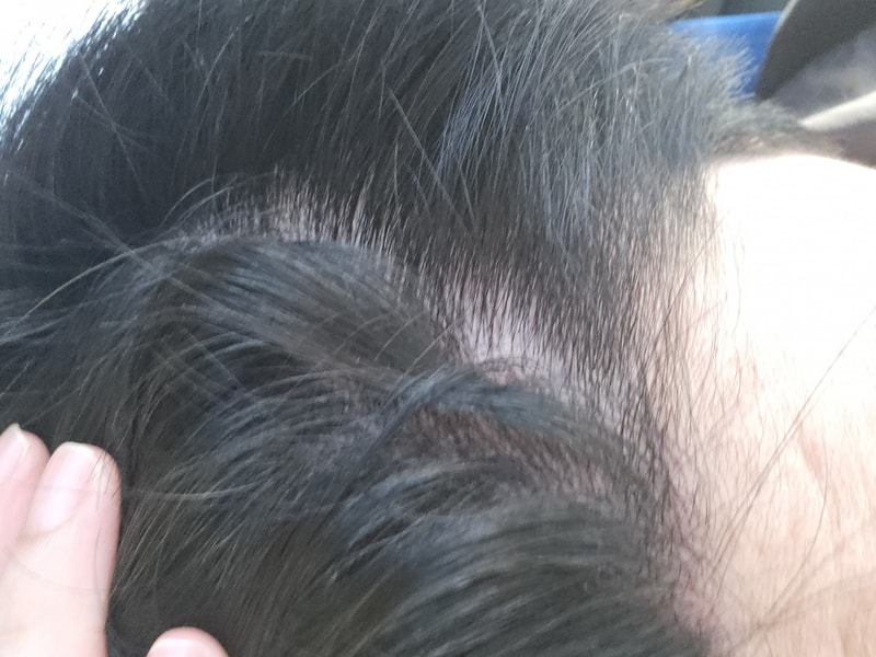 这种整体密度降低到底是什么呢？