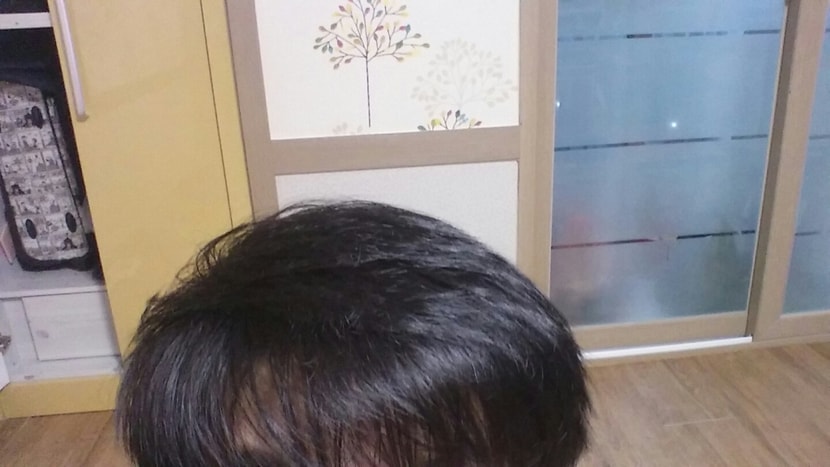 일반정면
