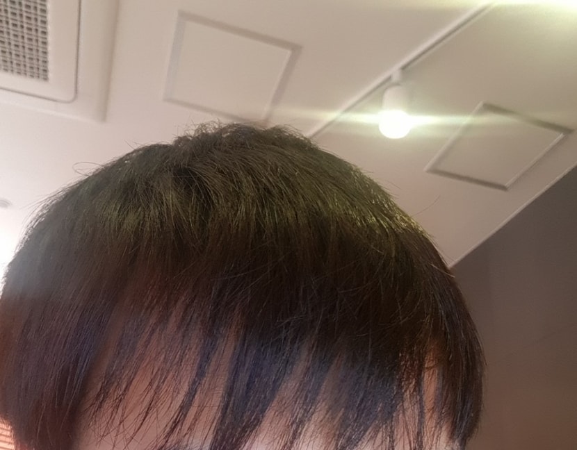 이건 자를때 숱을 많이 잘라서 그런거아닌가요?