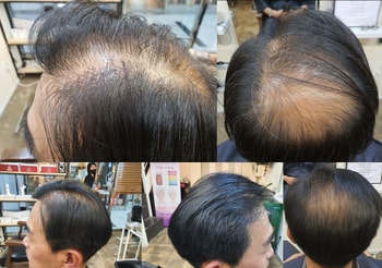 + 60대, 남, 총 6개월