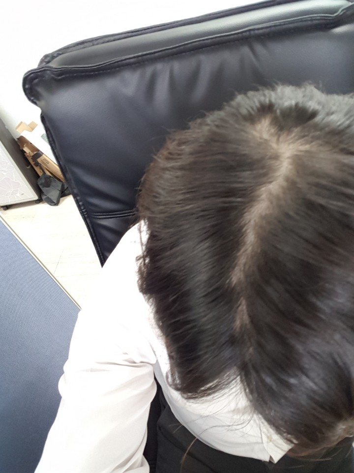 초기 사진
