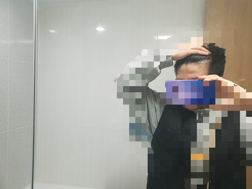 얼굴기준으로 오른쪽인데 왼쪽보다는 없는것같아요