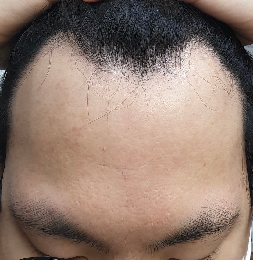 올해 초 복용 전