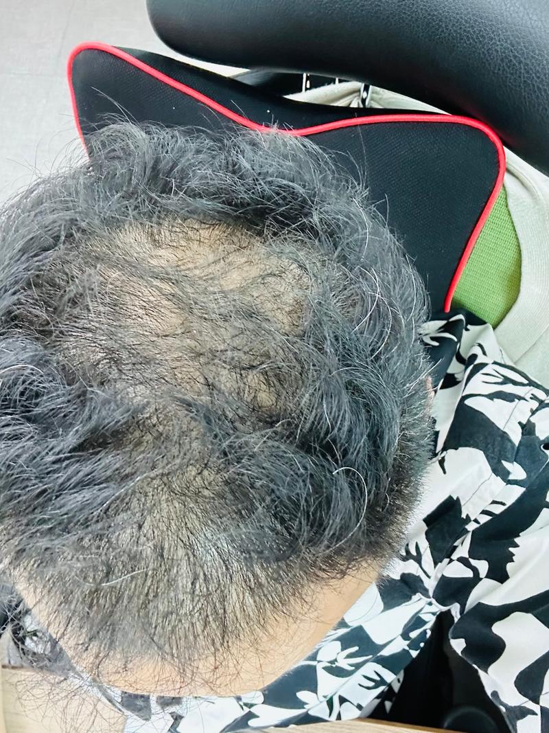 캬 100일 됐는데 가마가 만져지네요