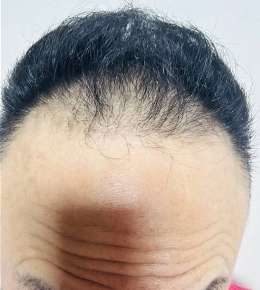 비참한 시절 2