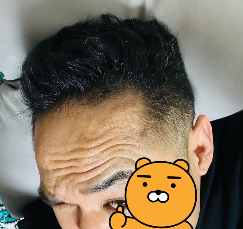 신기하게 관자놀이에 없던 옆 머리도 생겼습니다