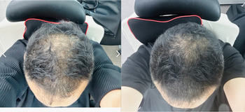 약먹고 30일,           약먹고 75일