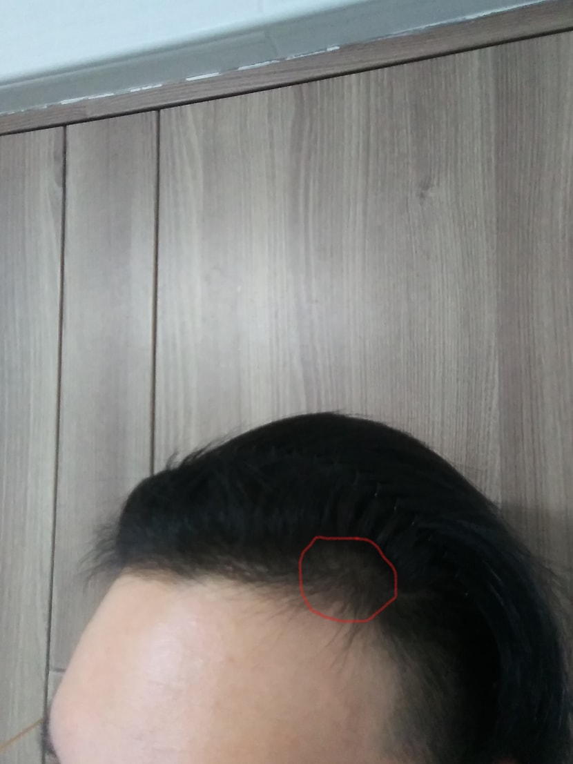빛 없는 곳